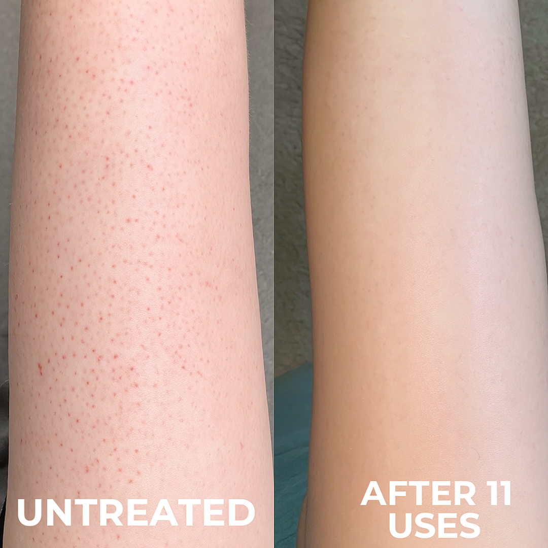 Blenada Berry - Strawberry Skin Smoother