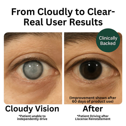 Zoone Advanced Eye Shield Capsules